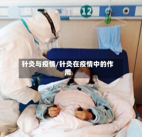 针灸与疫情/针灸在疫情中的作用-第2张图片