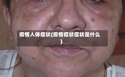 疫情人体症状(疫情症状症状是什么)