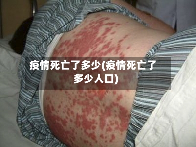 疫情死亡了多少(疫情死亡了多少人口)-第2张图片