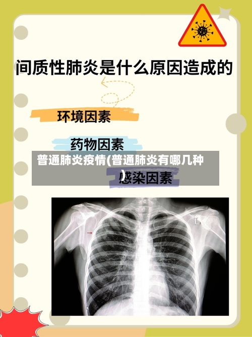 普通肺炎疫情(普通肺炎有哪几种)-第2张图片